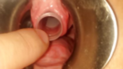 صورت است, , انجمن دانلود کلیپ های سکسی الکسیس تصویری از یک دختر بسیار